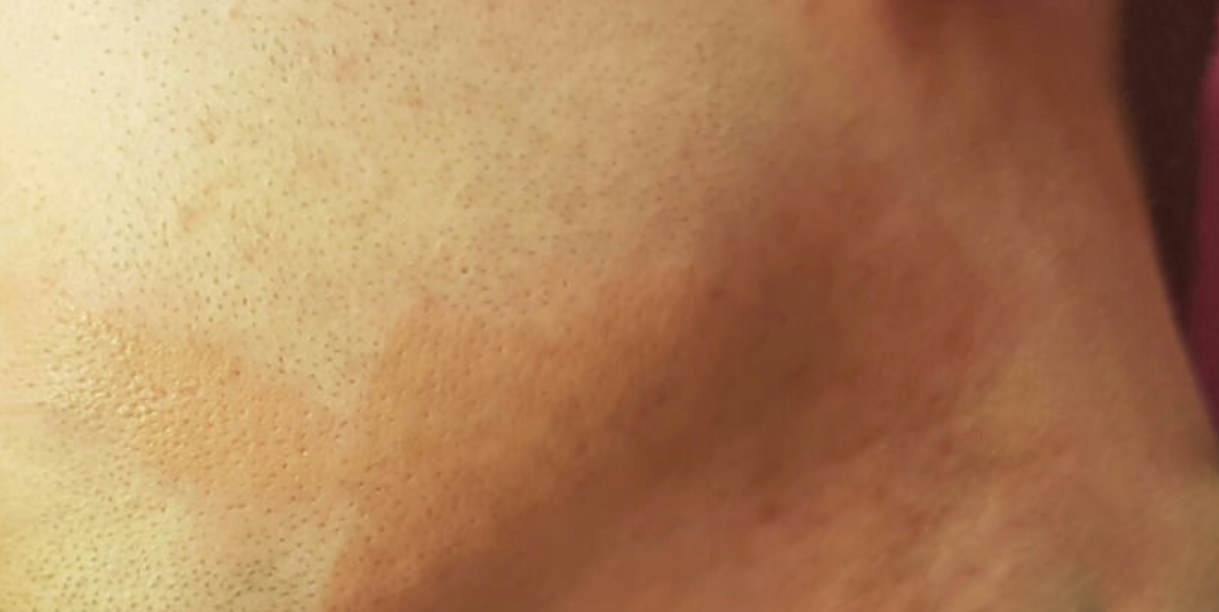 Dermopigmentazione%20Menu