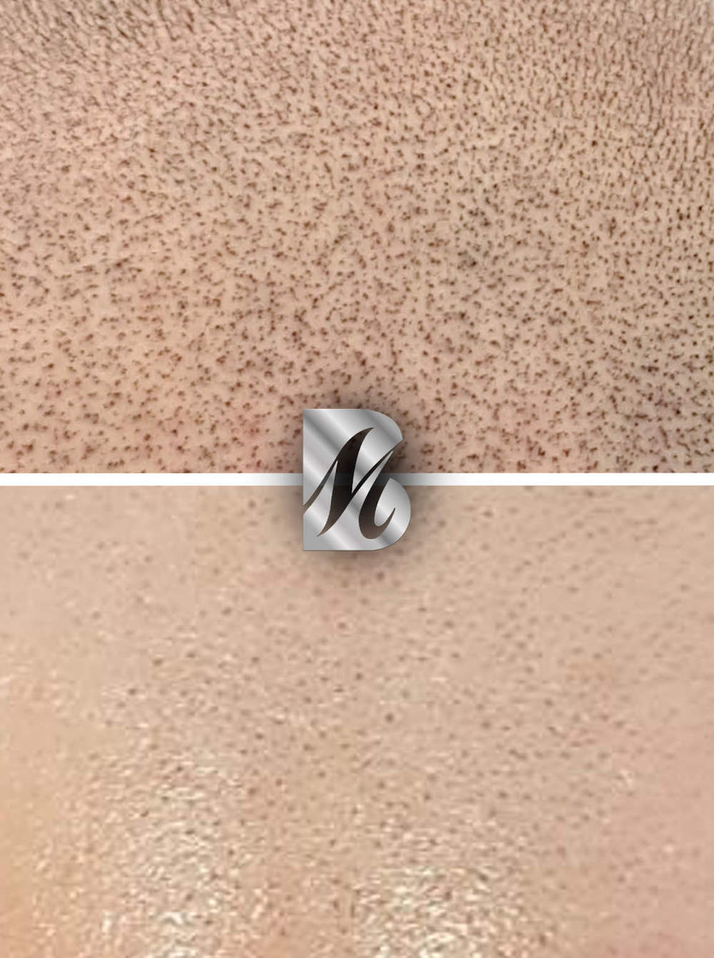 Post%20Tricopigmentazione%2011%20copy