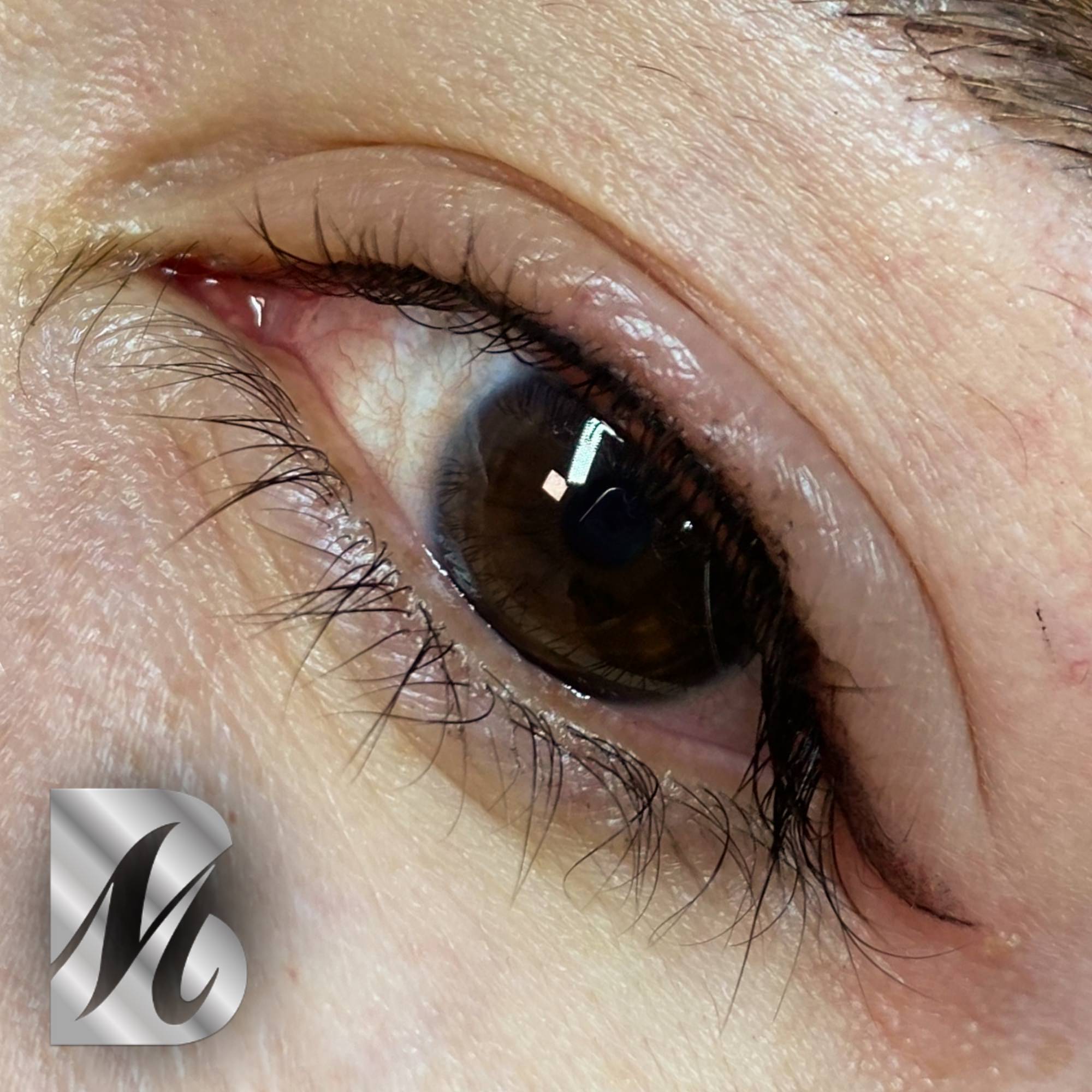 Post%20Sopracciglia%20178%20DX