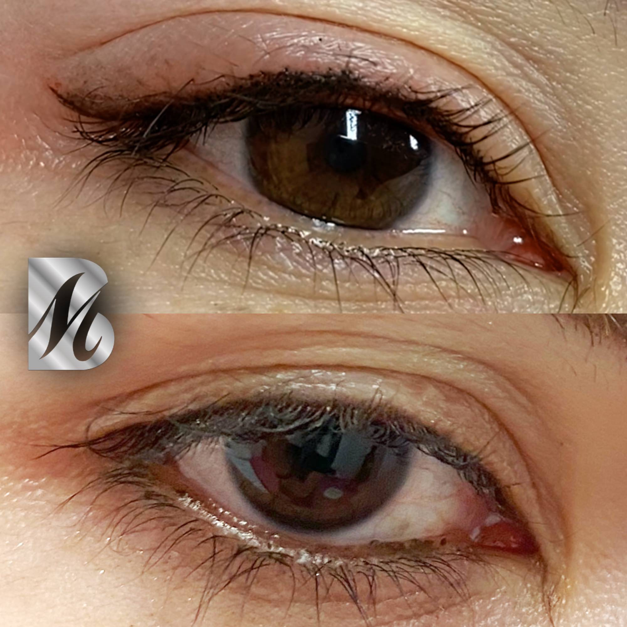 Post%20Sopracciglia%20178%20DX