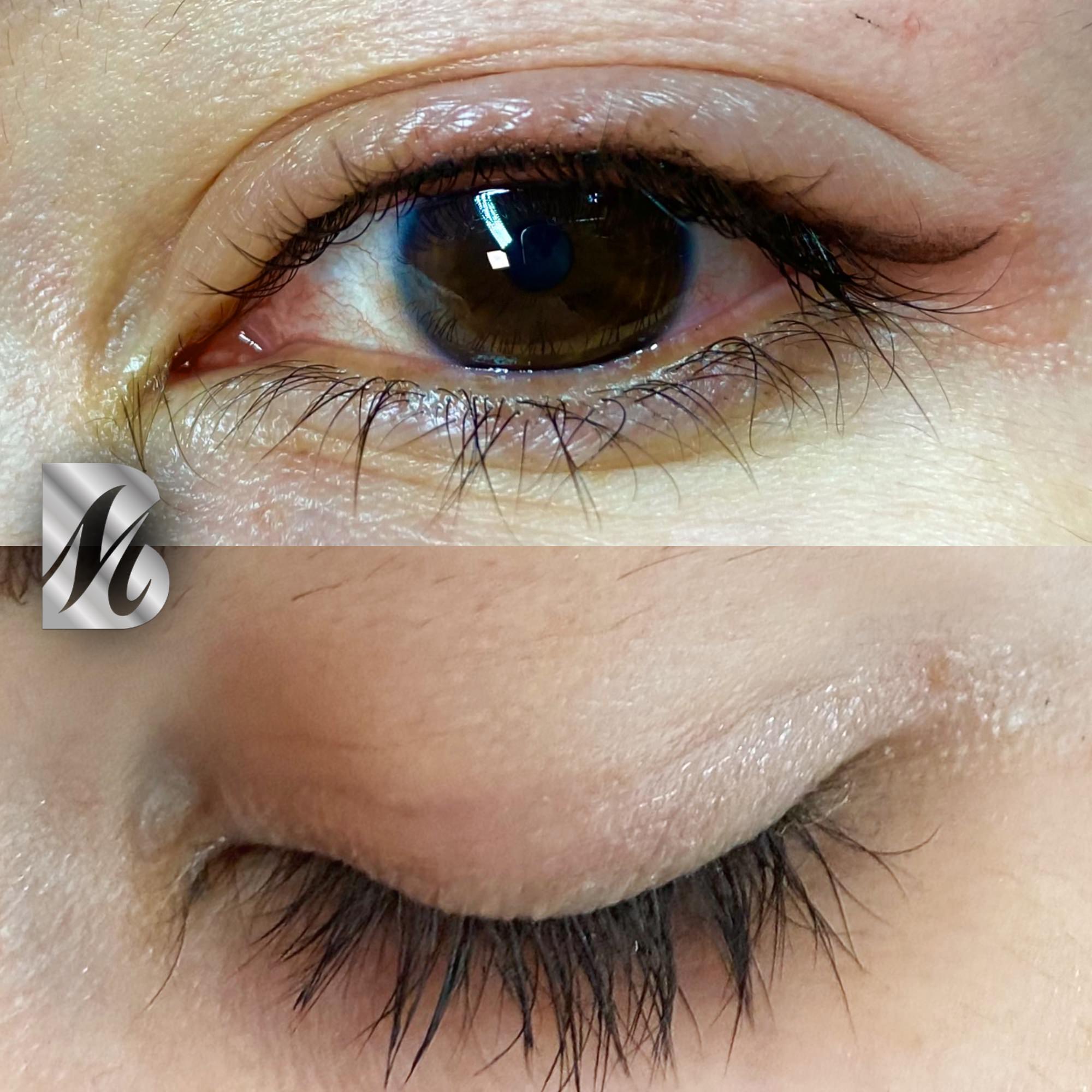 Post%20Sopracciglia%20178%20DX