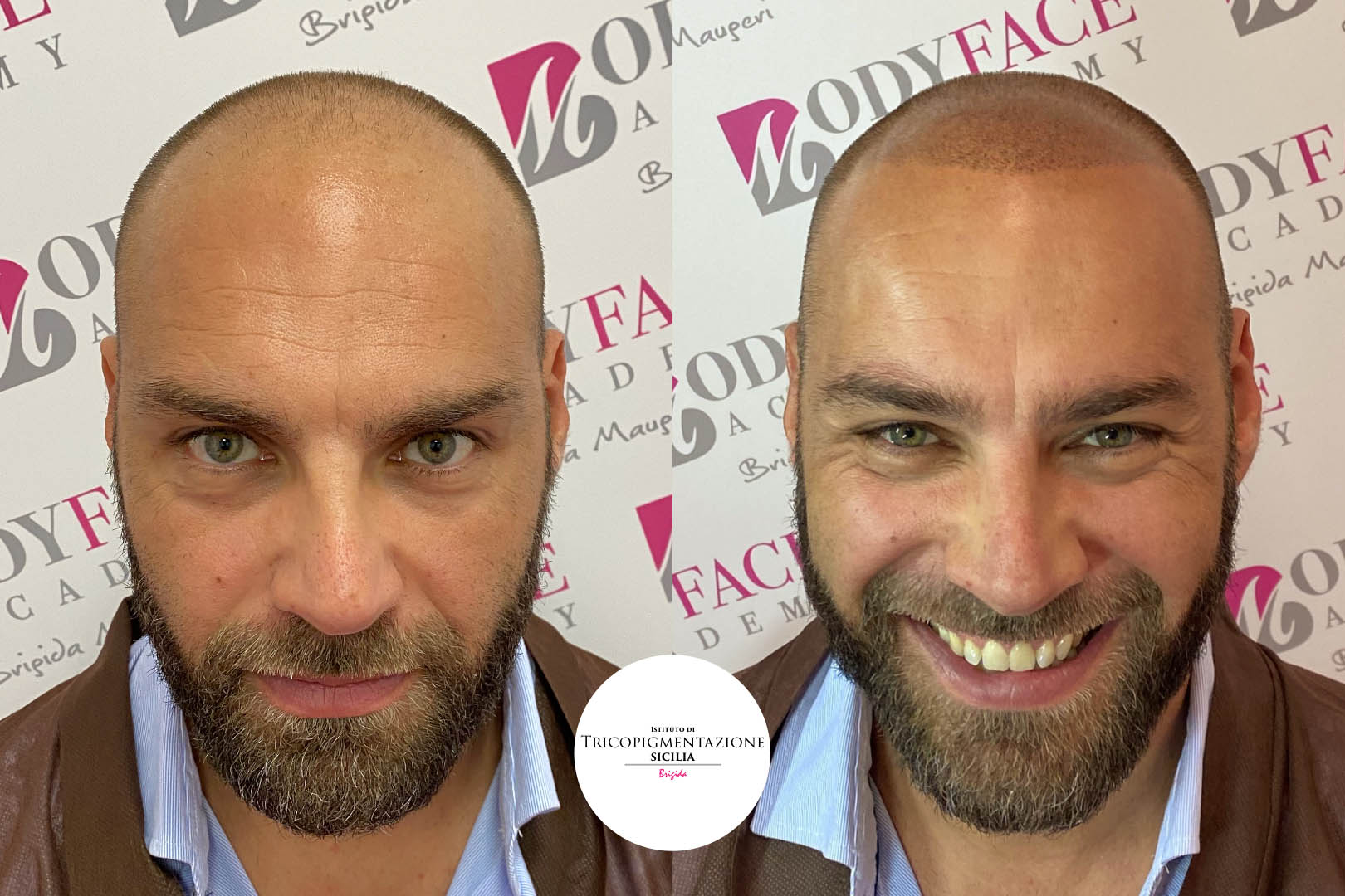 Post%20Trico%20178%20DX