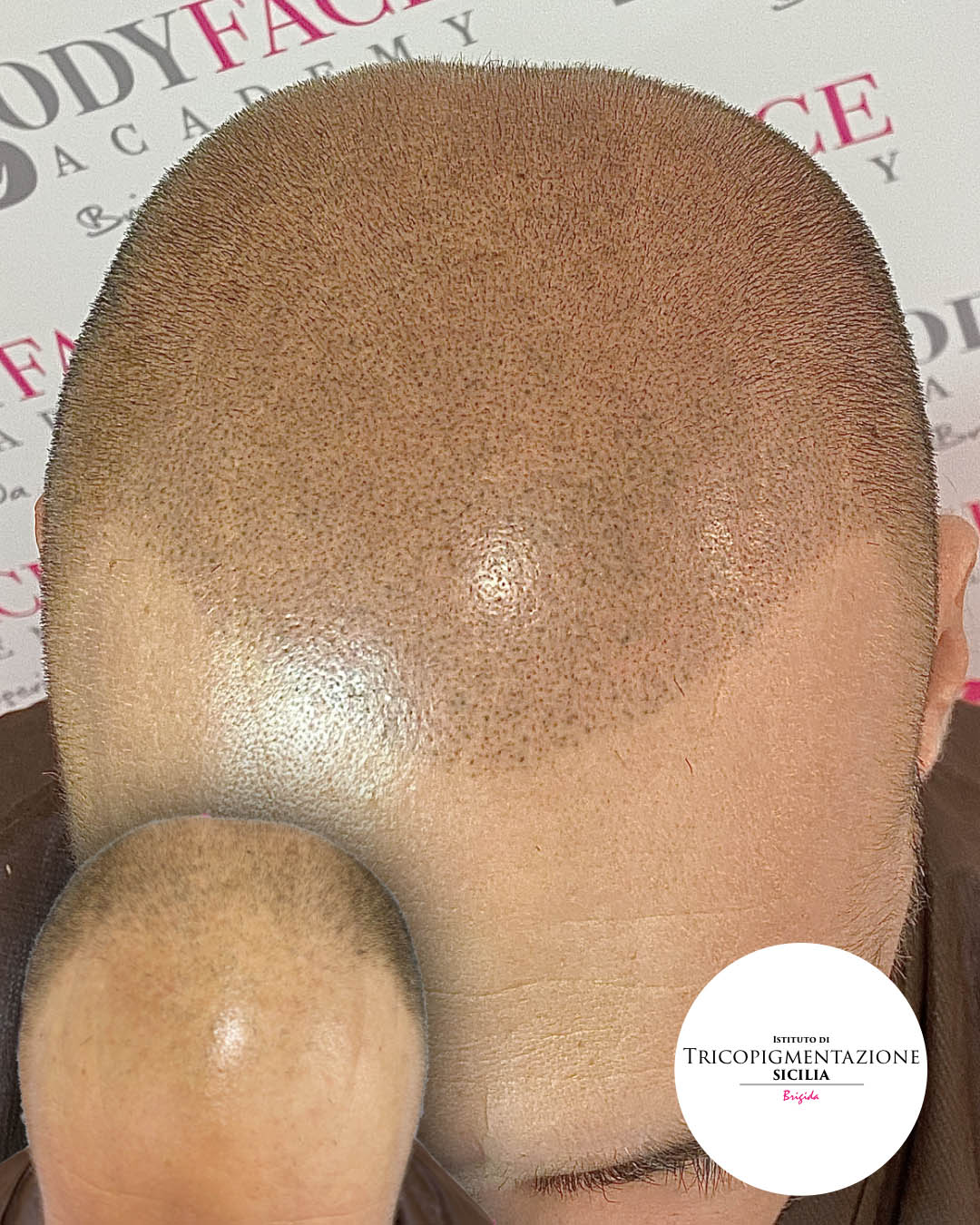 Post%20Trico%20178%20DX