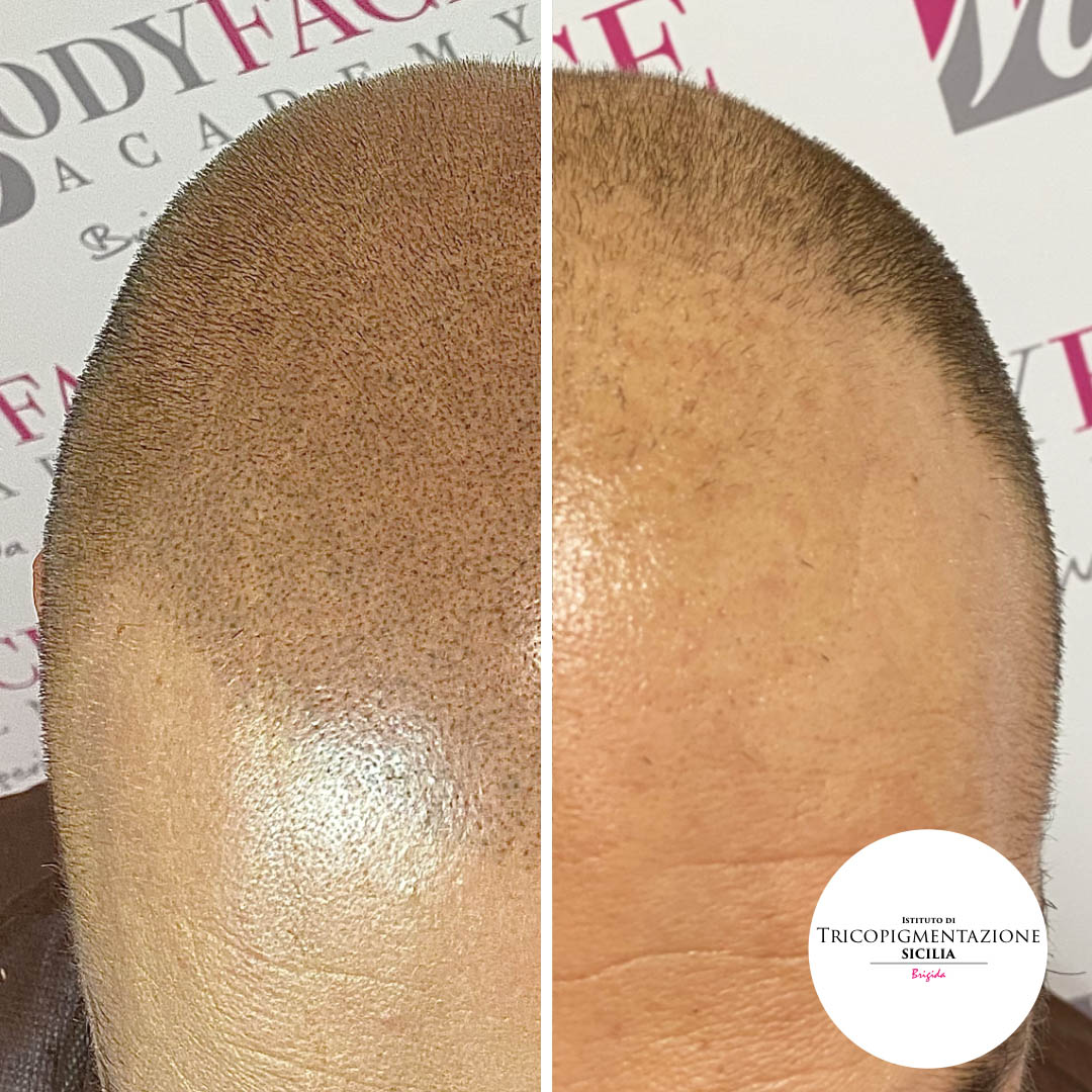 Post%20Trico%20178%20DX