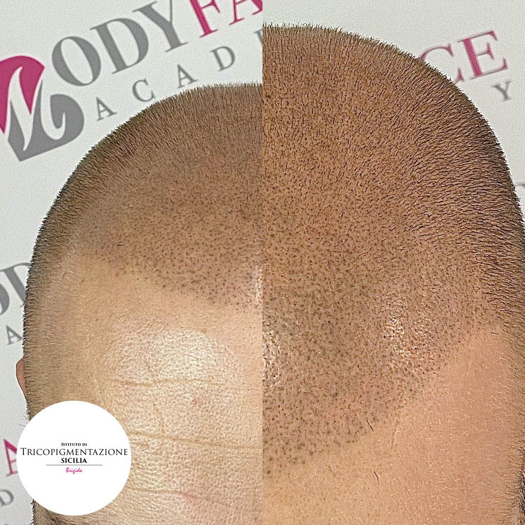 Post%20Trico%20178%20DX