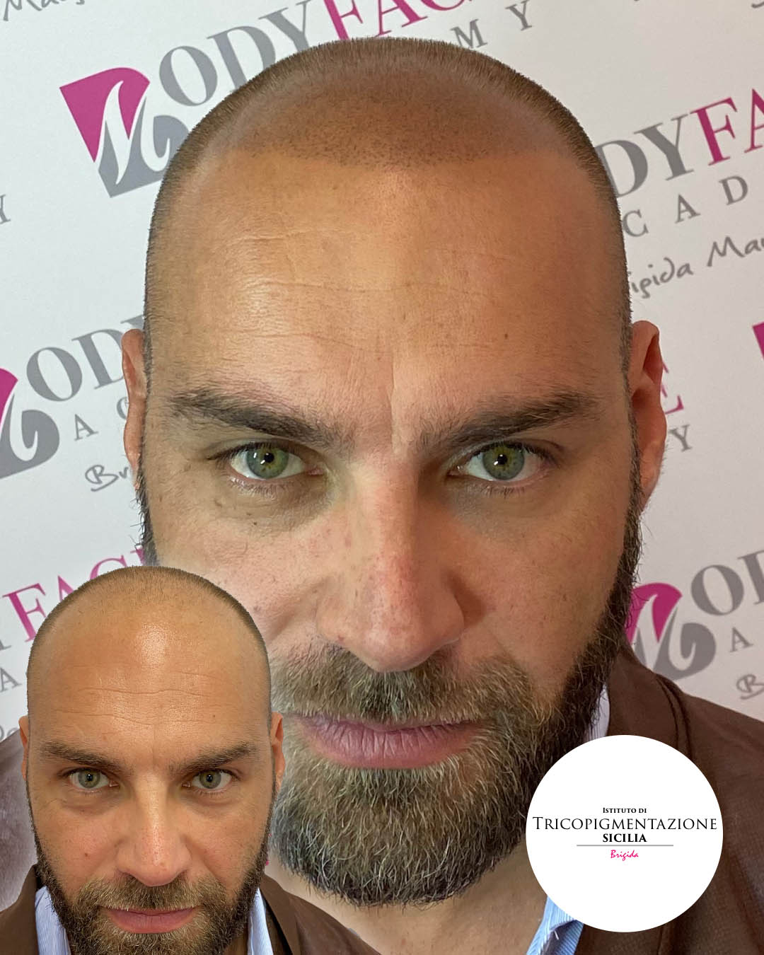 Post%20Trico%20178%20DX