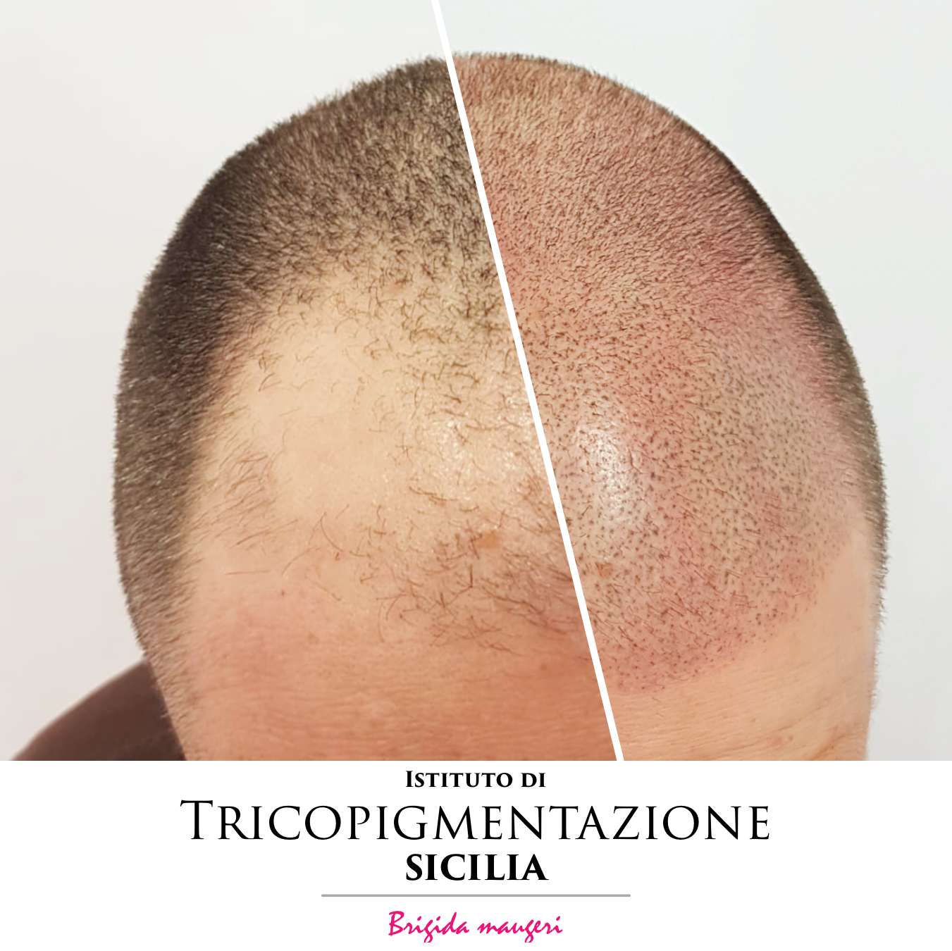 Post%20Trico%20178%20DX