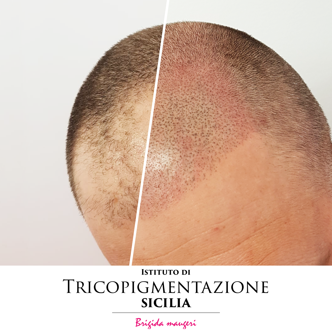 Post%20Trico%20178%20DX