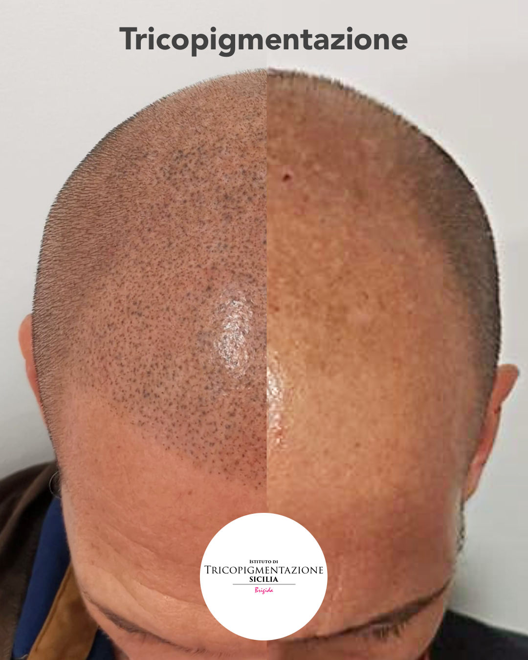 Post%20permanentecapelli%20178%20DX