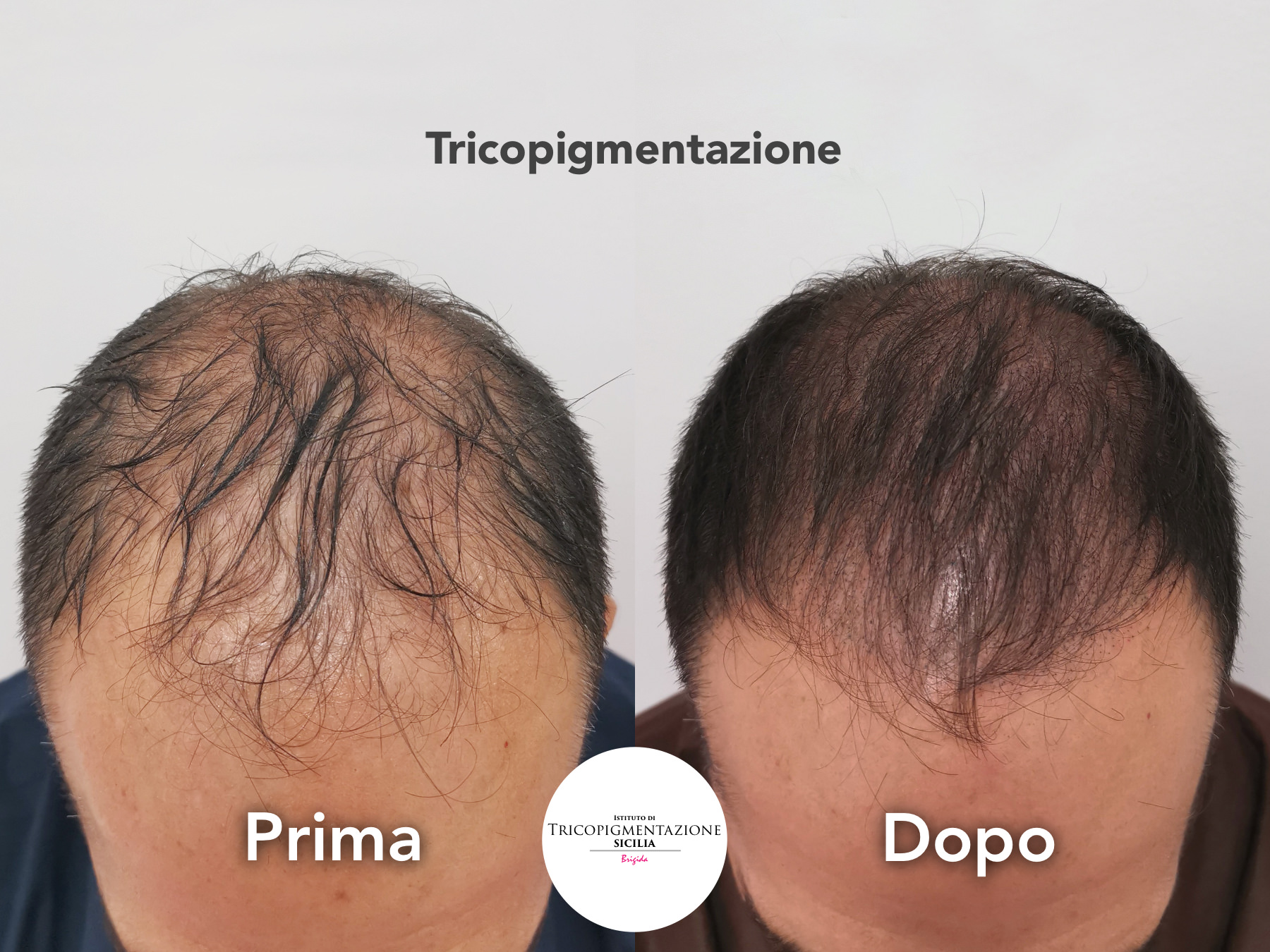 Post%20Trico%20178%20DX