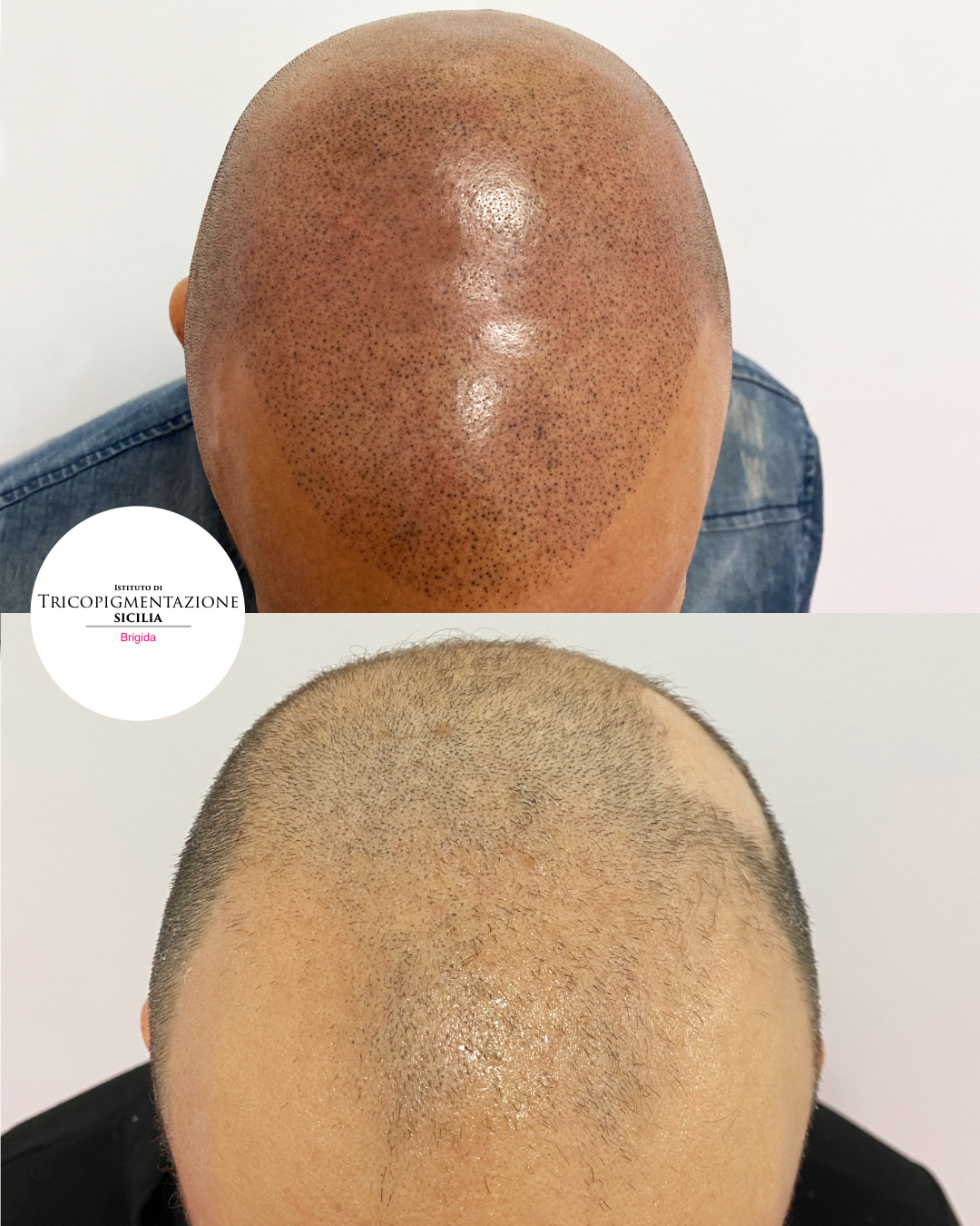 Post%20Trico%20178%20DX