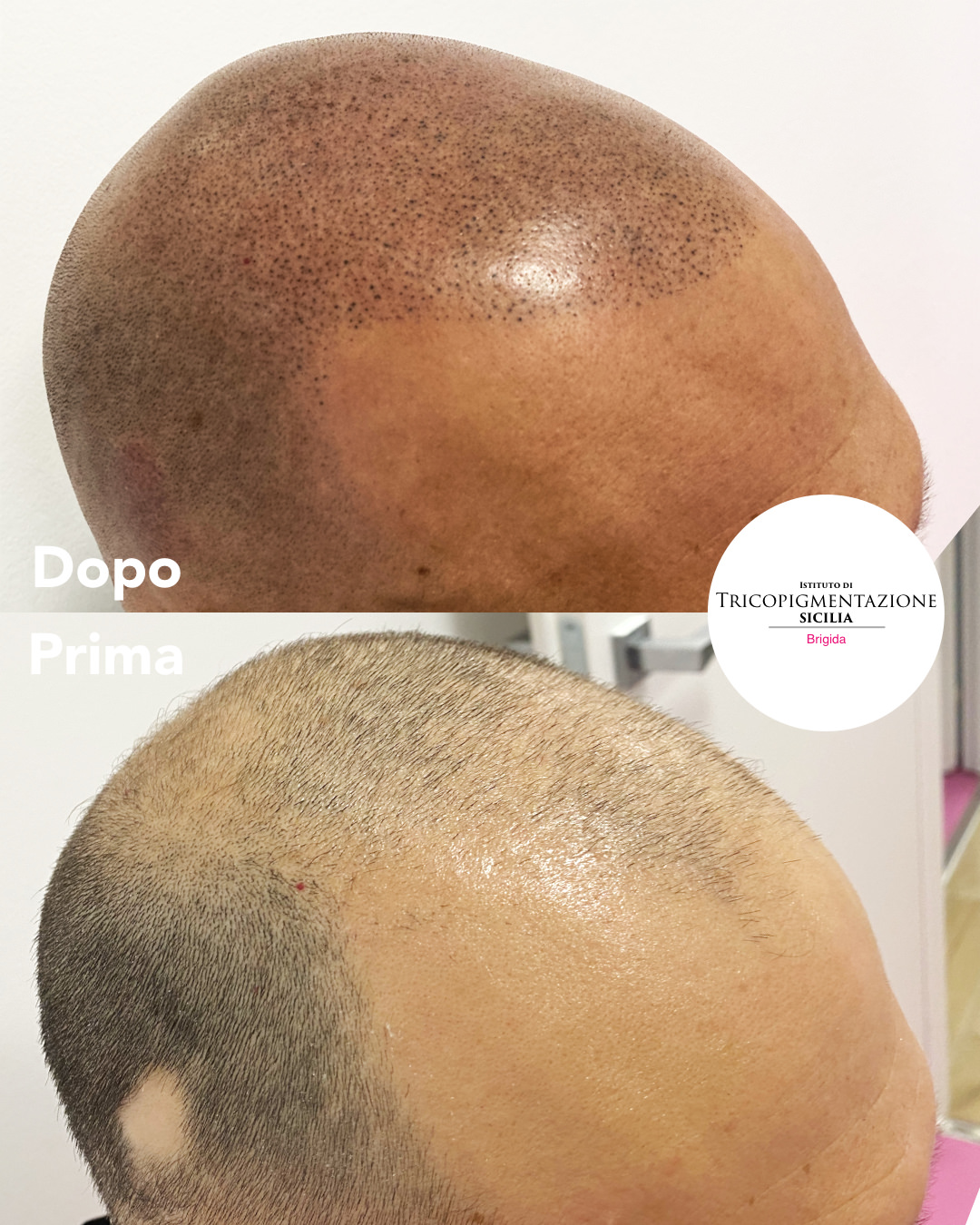 Post%20permanentecapelli%20178%20DX