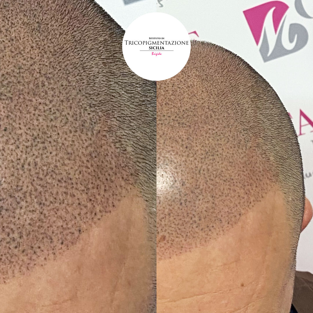 Post%20Trico%20178%20DX