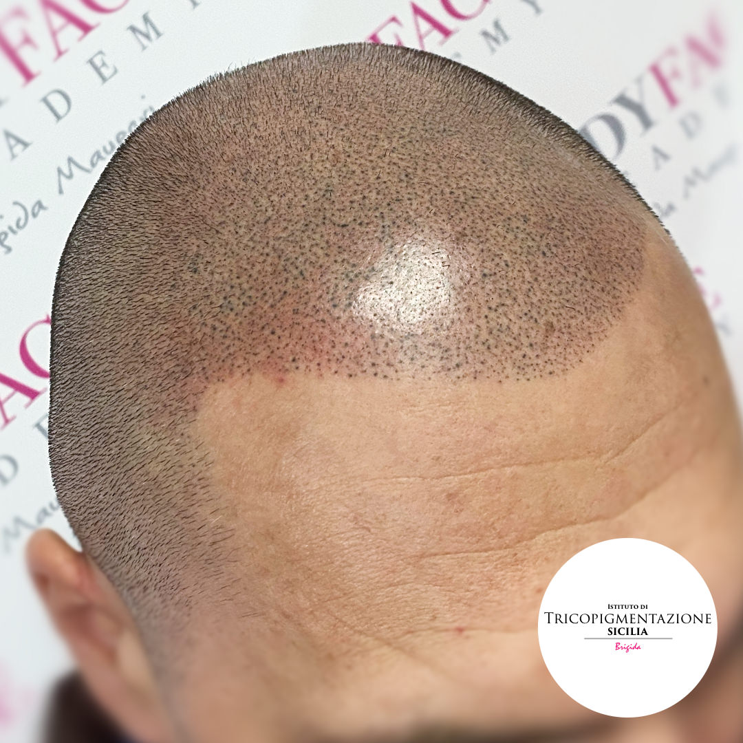 Post%20Trico%20178%20DX