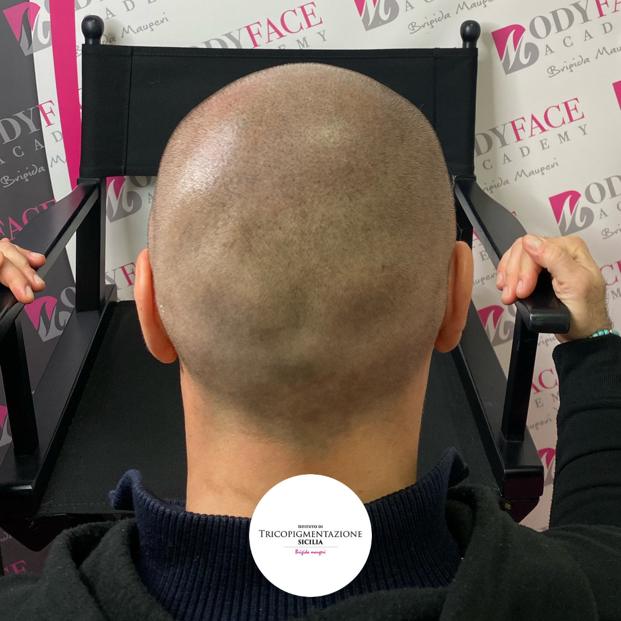 Migliore tricopigmentazione