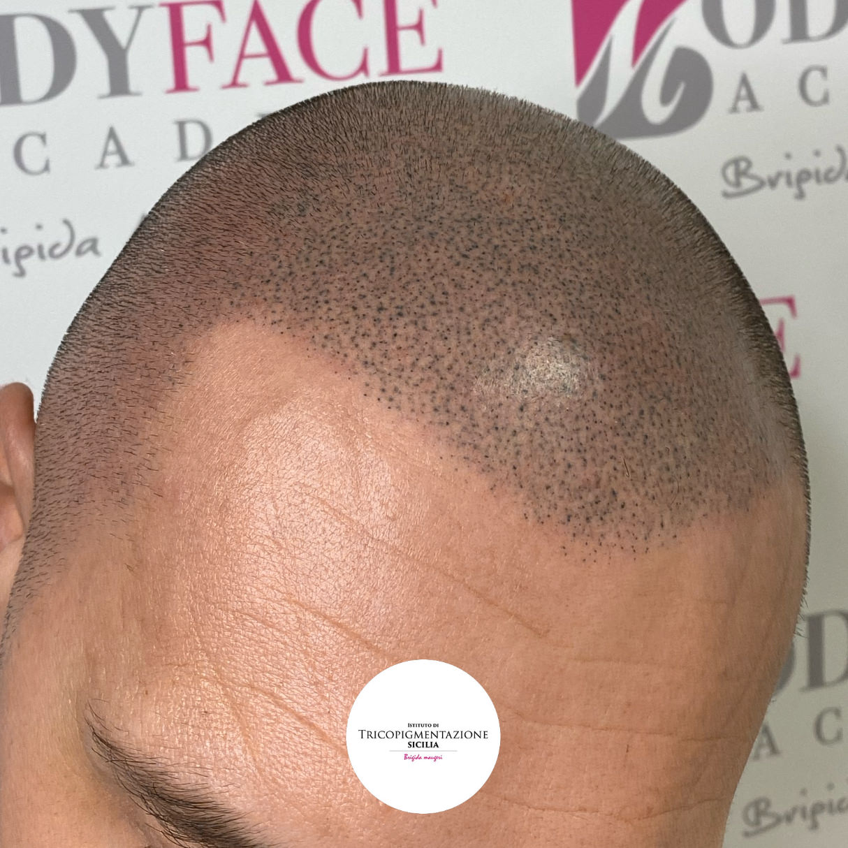 Migliore tricopigmentazione