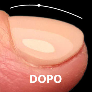 300 kombi-imperfezioni-dopo-struttura