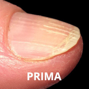 300 kombi-imperfezioni-prima-struttura