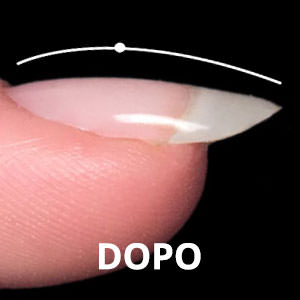 300 kombi-insu-dopo-struttura