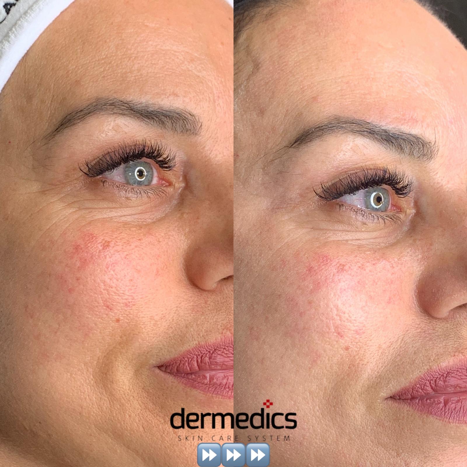 4d545923 08d1-472f-983f-84ff8f85d4ae.JPG