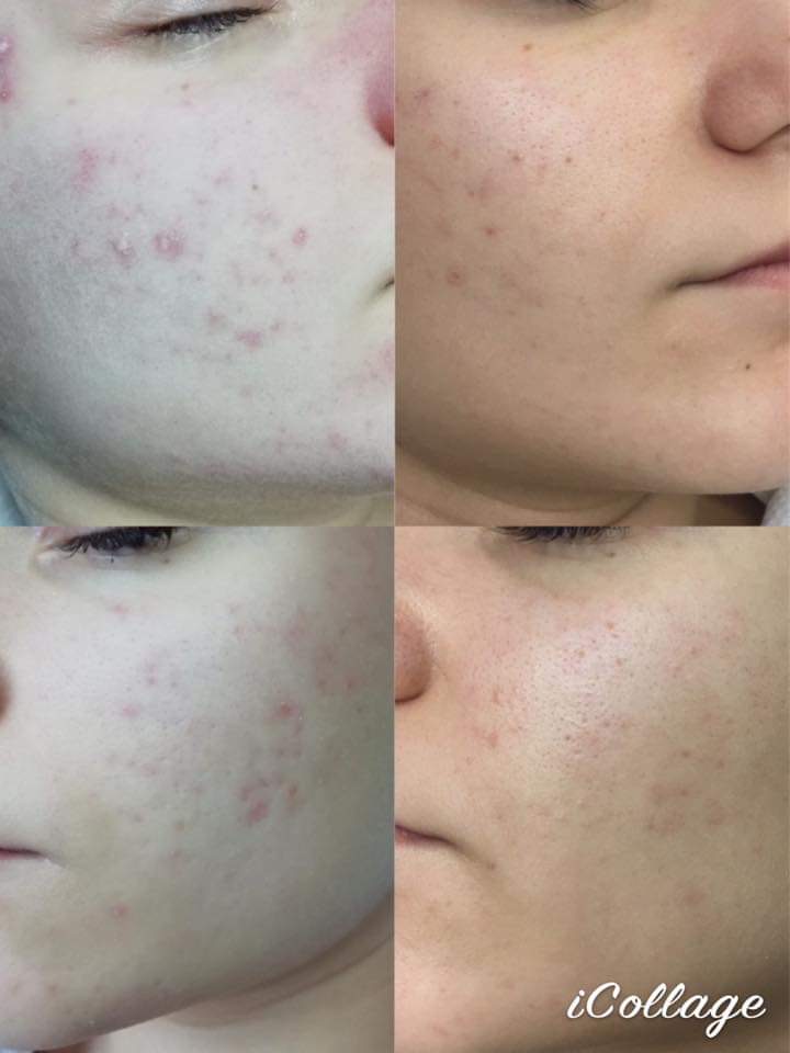 65e7e75a 1d53-47bb-8247-760b56f139dd.JPG