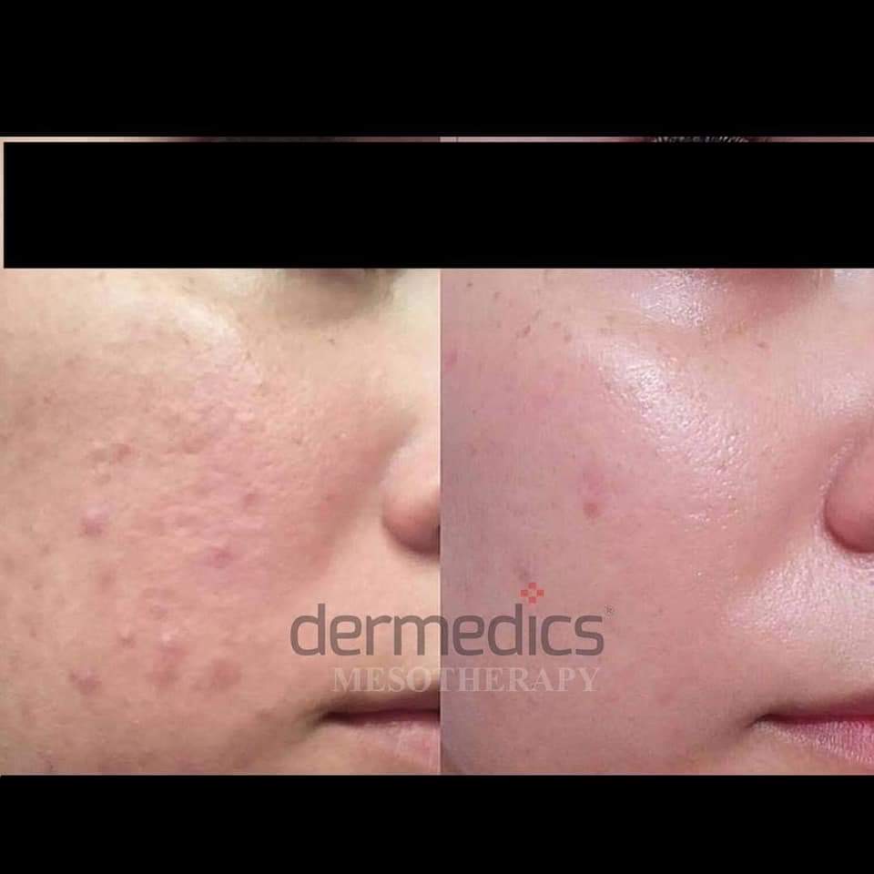 997951aa 8f64-4878-a54e-976dc1bf7c85.JPG