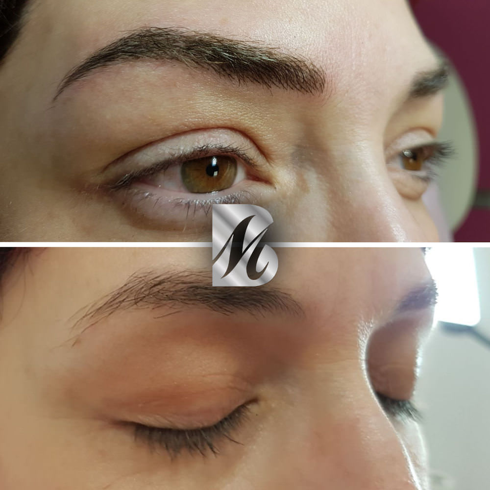 Post%20Sopracciglia%2089%20DX