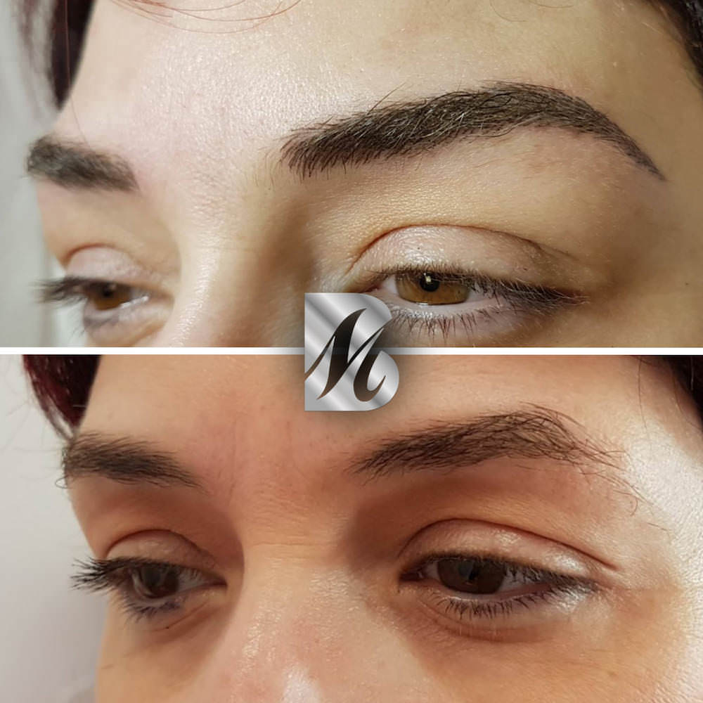 Post%20Sopracciglia%2089%20SX