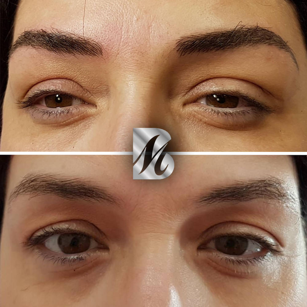 Post%20Sopracciglia%2089