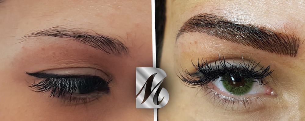 Post%20Sopracciglia%2093%20DX