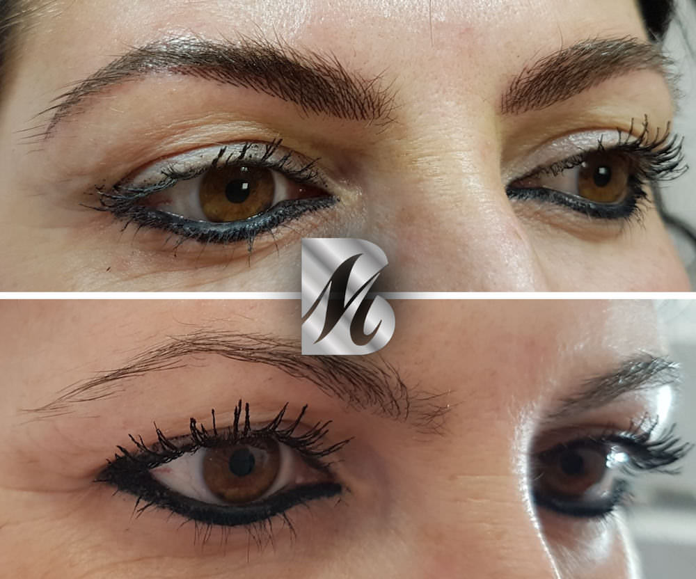 Post%20Sopracciglia%2095%20DX