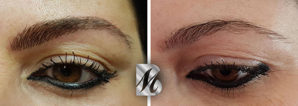 Post%20Sopracciglia%2095%20SX%20copy%202