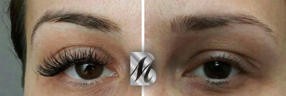 Promo%20Extension%2010