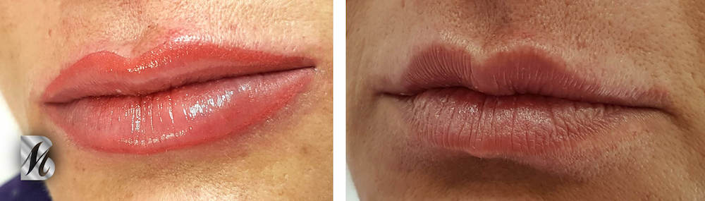 Untitled%2024%20copy