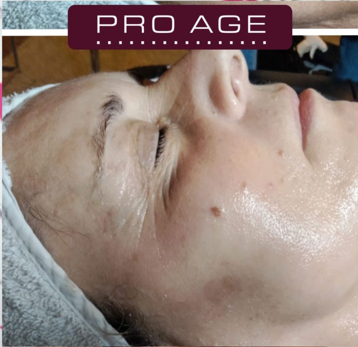 AntiAge senza Aghi di Brigida Maugeri