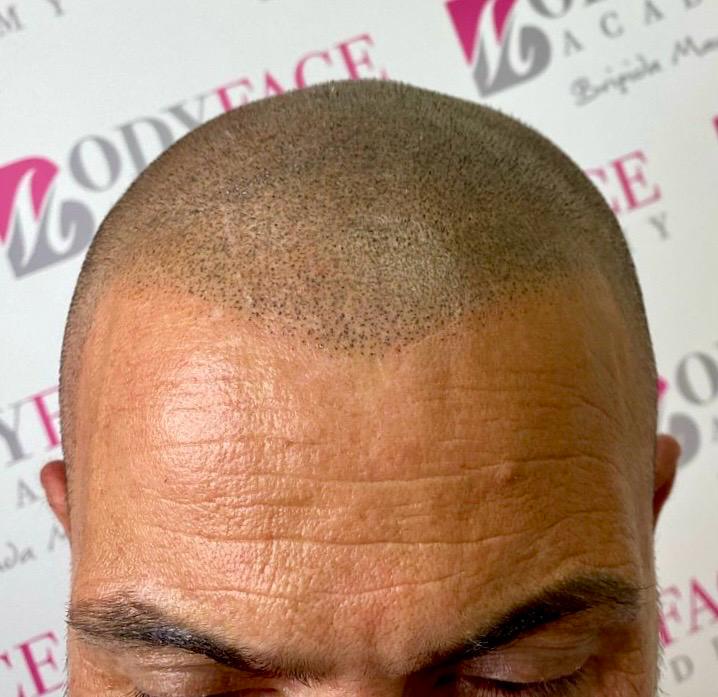 Tricopigmentazione Naturale: Trattamenti Professionali di Brigida Maugeri