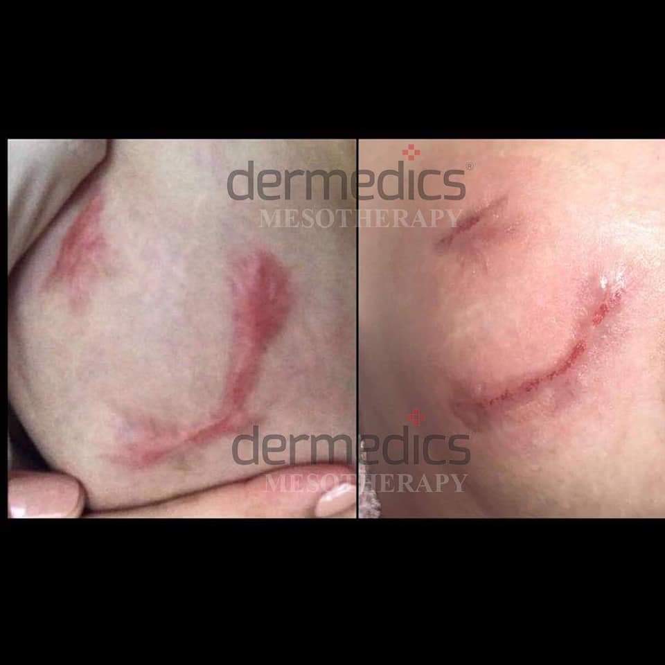 fa308ac5 eb76-4ca0-8a29-5c9fb3fdb4f5.JPG