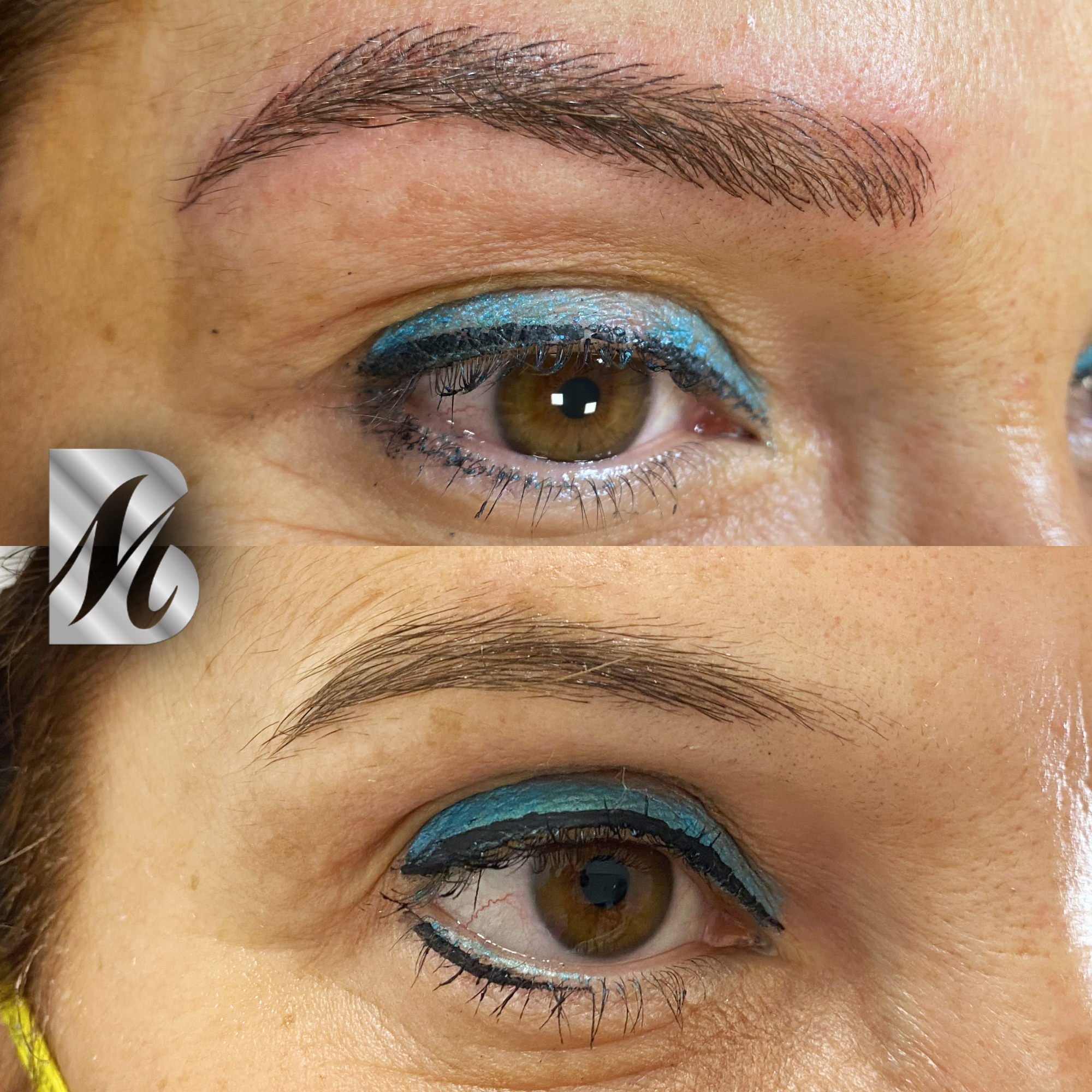 Post%20Sopracciglia%20178%20DX