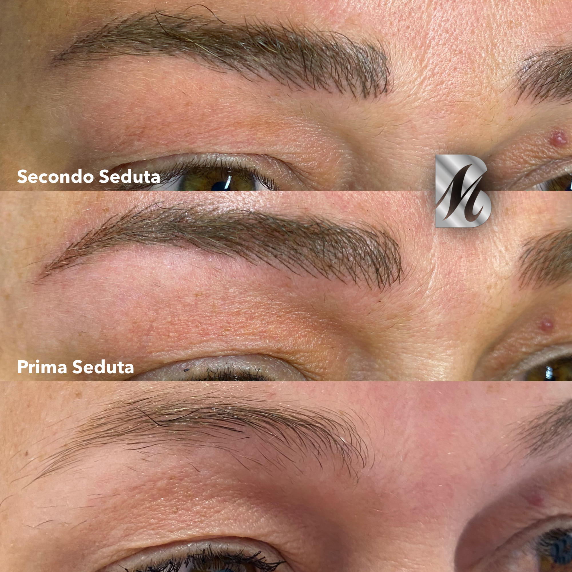 Post%20Sopracciglia%2093%20SX