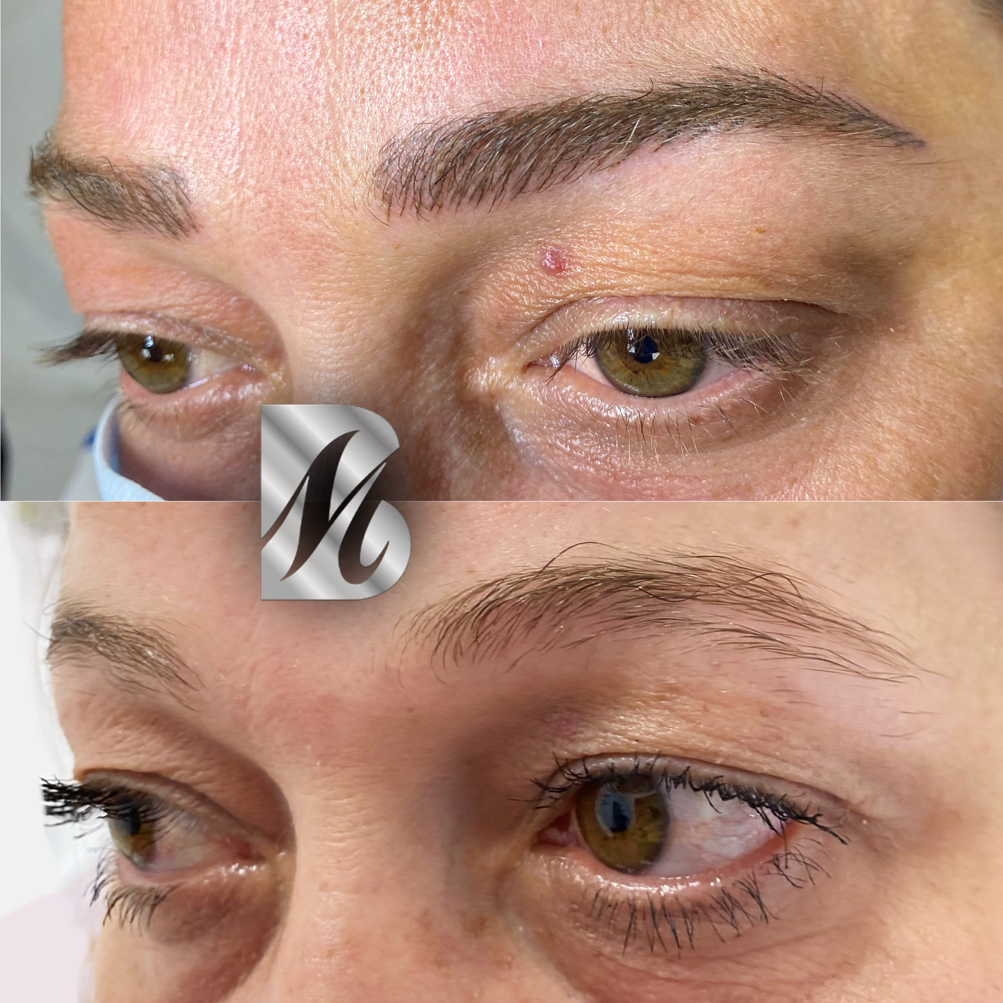 Post%20Sopracciglia%20178%20DX