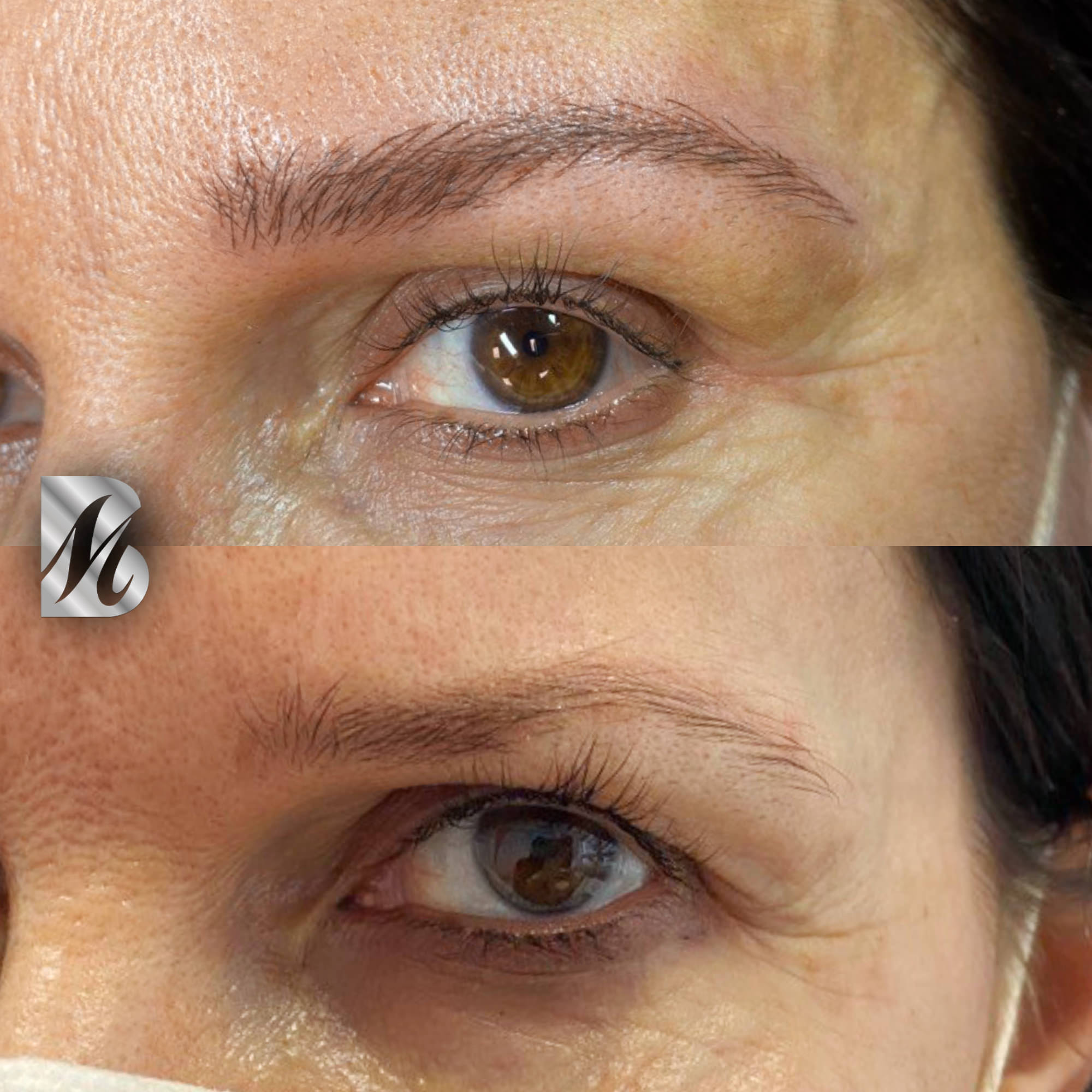 Post%20Sopracciglia%20178%20DX