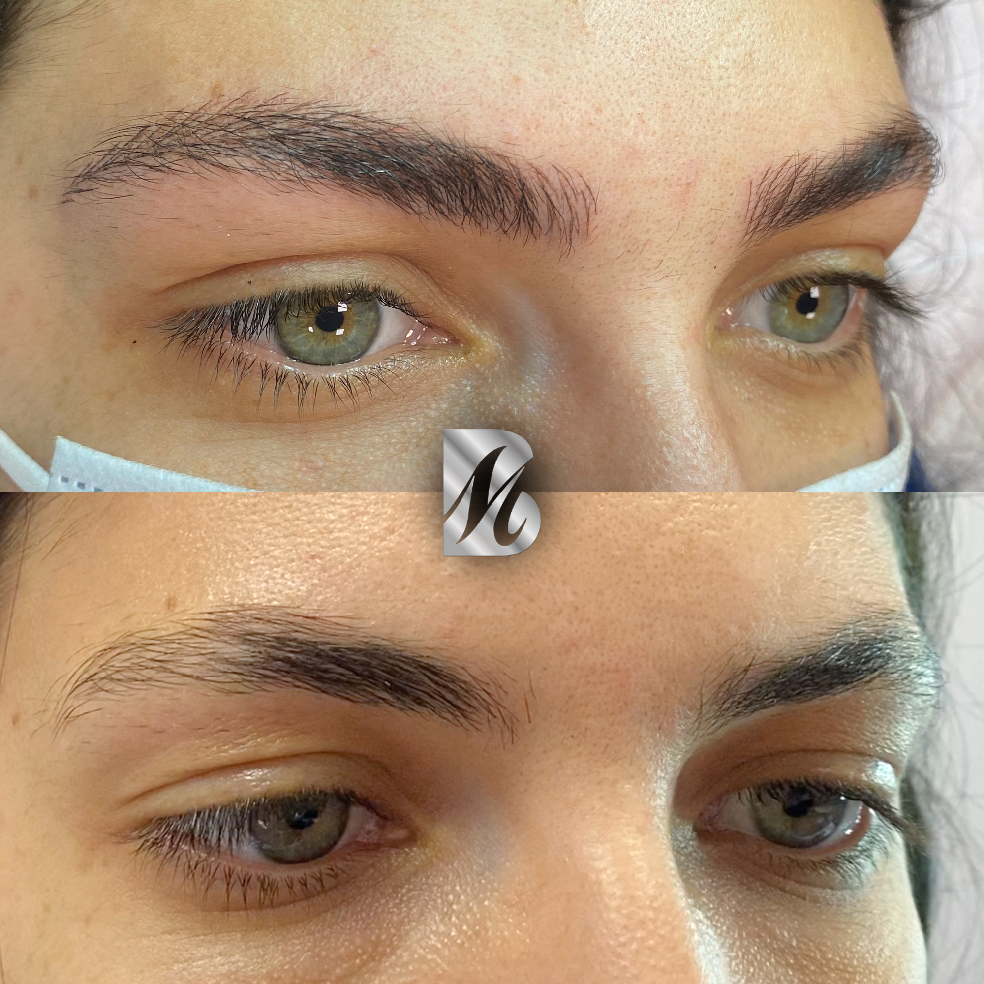 Post%20Sopracciglia%20178%20DX