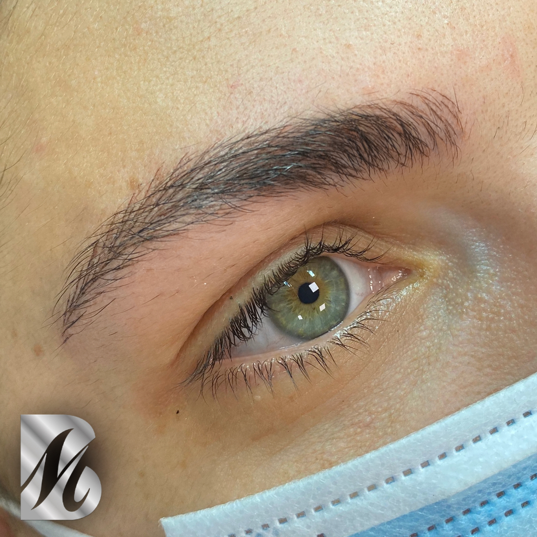 Post%20Sopracciglia%20178%20DX