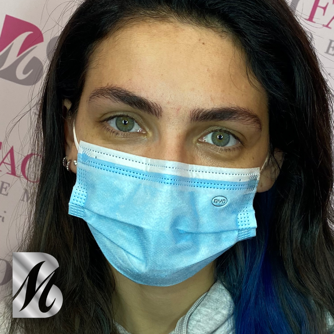 Post%20Sopracciglia%2093%20SX