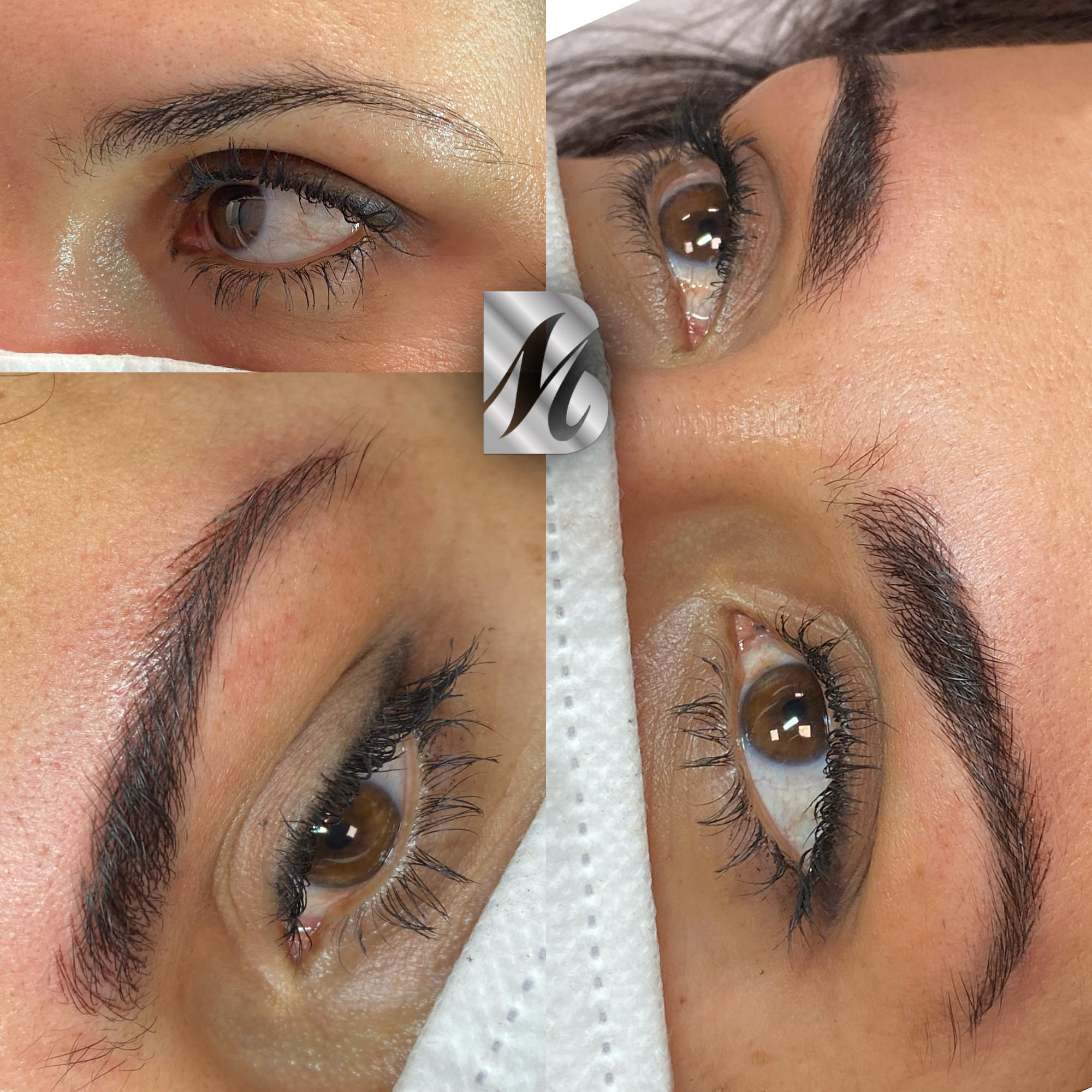 Post%20Sopracciglia%20178%20DX