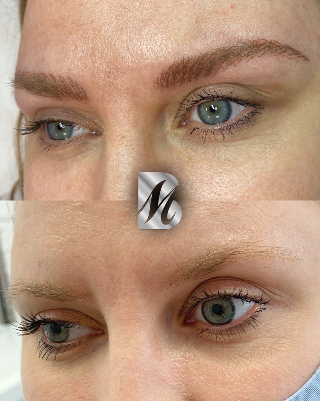 Post%20Sopracciglia%20178%20DX