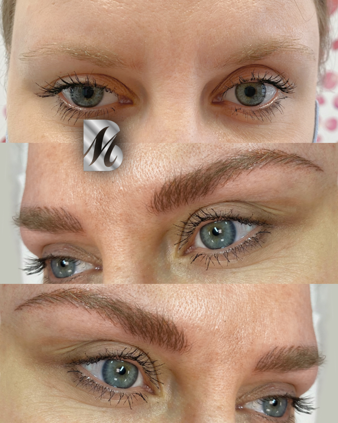 Post%20Sopracciglia%20178%20DX