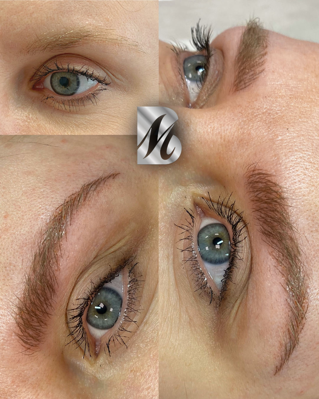 Post%20Sopracciglia%20178%20DX