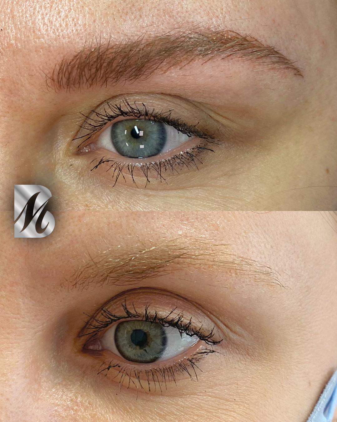 Post%20Sopracciglia%20178%20DX