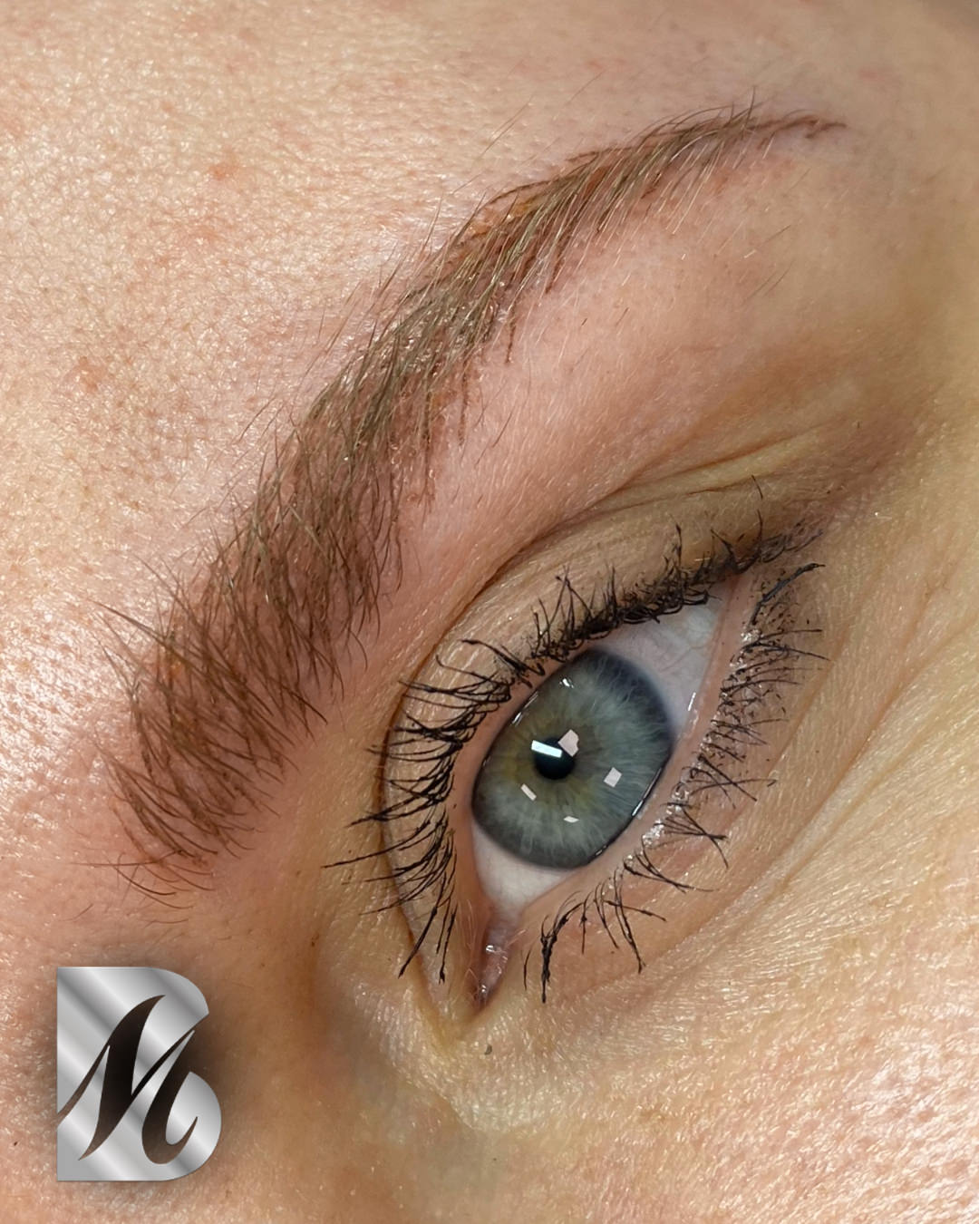 Post%20Sopracciglia%20178%20DX